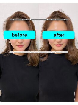 朱雀整骨院/小顔矯正