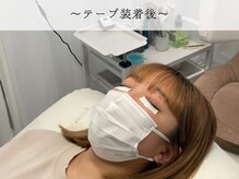 ラッシュ ビジョン 彦根(Lash Vision)/施術手順 2