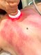 ローズ(ROSE)の写真/贅肉撃退★最新痩身マシン1台5役【セルラジ】導入！内臓脂肪や皮下脂肪、セル脂肪などあらゆる脂肪に♪