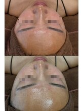 ルーク(Luke)/ビフォーアフター