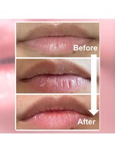 フィル 名駅店(fil)/ローマピンク【唇】