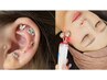 耳ツボジュエリー付け放題+小顔.フェイスラインスッキリコース
