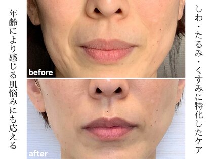 ラジェ 静岡呉服町店(LAGE)の写真