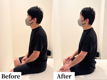 ソレア(Solea)/首こり・肩こり・猫背改善10回目