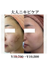 アルルプラス 山科(ARuru+)/before after