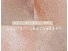 ラシュール(Rassure)