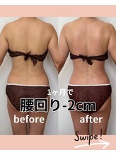 リリー(Lily)/上半身1ヶ月