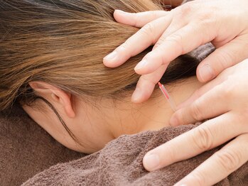 けいのき鍼灸整骨院/肩こり/整体/マッサージ/リンパ