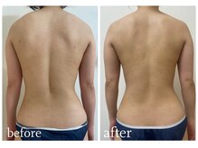 加圧ビューティーサロン スタイル エム(beauty salon style M)/20代/発汗スリミングリンパ120分