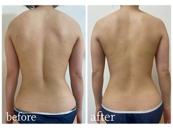 加圧ビューティーサロン スタイル エム(beauty salon style M)/20代/発汗スリミングリンパ120分