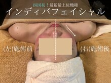 ヒヨリ(hiyori)