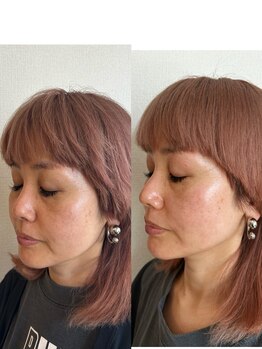 モモラ(Spa MoMora)/一目で納得！港区白金台