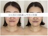 【初回】疲れ顔解消！引上げたるみケア光フェイシャル60分¥4,980