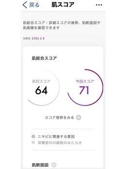 ポーラ エステティックMoana店(POLA)/肌分析