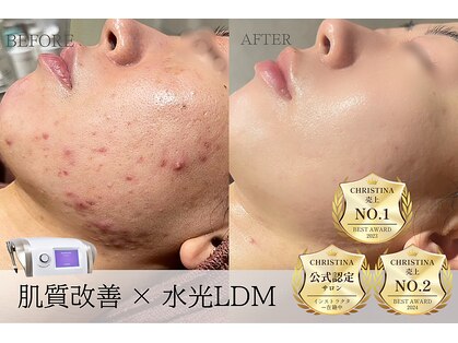 アルフォービューティー 広島店(ALU for beauty)の写真