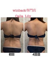 カラーリリー(Calla Lily)/上半身（4回目）