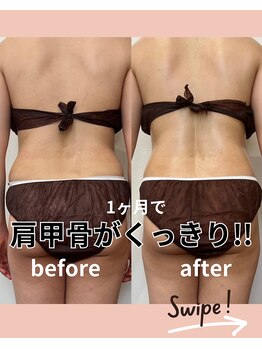 リリー(Lily)/上半身1ヶ月