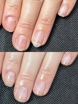 リエル(RIELE)の写真/【効果が実感できる自爪育成◎】"爪の形"を変えたい方に…プロによる本格育成ケアで縦長で健康的な美爪に♪