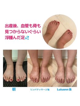 ヨサパーク ココロ 町田店(YOSA PARK COCORO)/産後のむくみ解消！