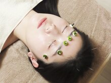 くろねこはりきゅう院/眼精疲労に対しても