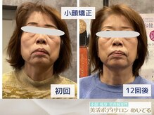 めいてるの雰囲気（バキバキしない小顔矯正でリラックスしながら変化がわかる◎）
