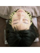 まつの鍼灸院 年齢肌の たるみ撃退