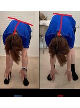 鍼灸接骨慈康院/歪みが整ってきました