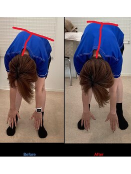 鍼灸接骨慈康院/歪みが整ってきました