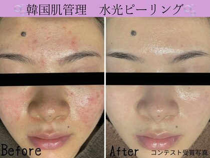 レイズ(RAISE)の写真