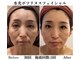 リュール(Lueur)の写真