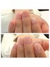 人気モニター【深爪改善ワンカラー】育成ケア+長さだし+ワンカラー仕上げ