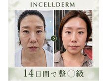 グリーンオーガニック(Green Organic)の雰囲気（ホームケアでここまで綺麗に！まるで整◯級の変化！）
