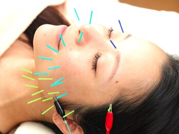 月海の写真/どこに行っても取れない！しつこい首肩コリ腰痛。気になる《ほうれい線・フェイスライン》すべて解消☆

