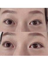 リボーテ(Reboaute)/アップフォースリフト