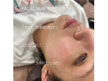 リモア(REMORE)の雰囲気（大人気のフェイシャルWAXワックス顔剃りから解放！）