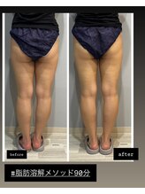 ラヴィエール(Laviere)/【美容溶解メソッド90分】