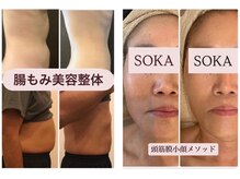 ソカ(SOKA)