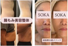 ソカ(SOKA)