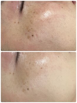 リノ(Lino)/プラズマニア1回の変化♪