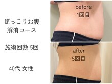 ほねつぎ一休さん 宇品店/ぽっこりお腹解消コース