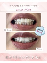 エクシアホワイト 立川南口店/通い放題のホワイトニング