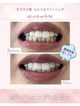 エクシアホワイト 立川南口店/通い放題のホワイトニング