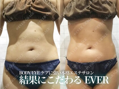 エヴァーグレース 川崎店の写真