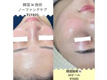 プリエ(Prier)の雰囲気（韓国皮膚科監修ノーファンデ♪ウルツヤ肌へ）