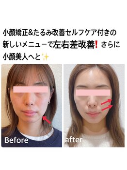 ナゴミ(NAGOMI)/左右差・歪み改善コース