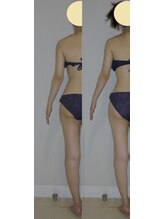 アルマ 芦屋(ALMA)/左だけの比較♪