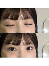 ニューム(nium)/ラッシュリフト上下