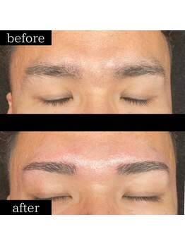 ユー 千葉駅前店(you)/症例写真