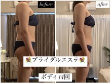 スラン(Slan)/ブライダルエステ