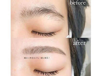 エステ パールの写真